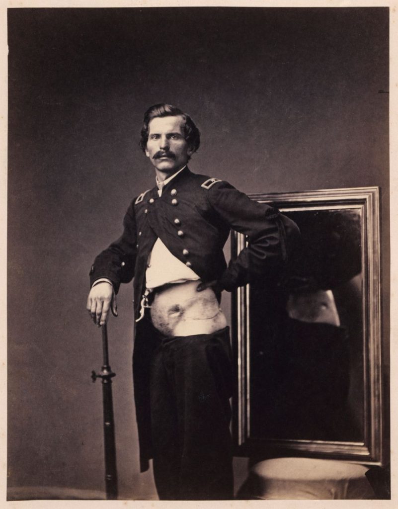  „Major H.A. Barnum, Genesung nach einer Bauchschusswunde, 1865
